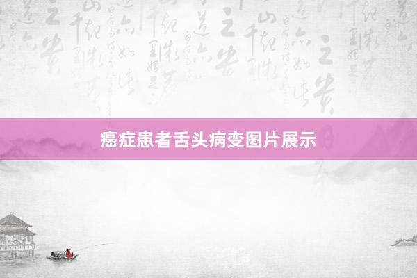 癌症患者舌头病变图片展示